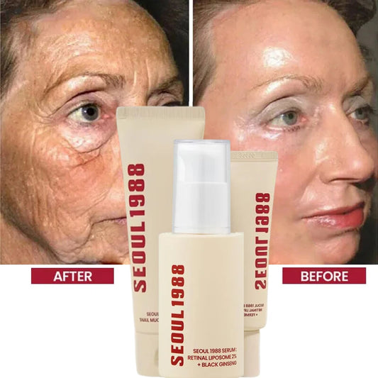 Korean 1988 Retinol Face Care Serum Black Ginseng Niacinamide 2% Acid Moisturizing Firming Cream Anti Aging Wrinkle Skin Care