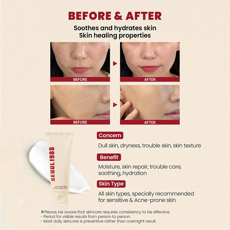 Korean 1988 Retinol Face Care Serum Black Ginseng Niacinamide 2% Acid Moisturizing Firming Cream Anti Aging Wrinkle Skin Care