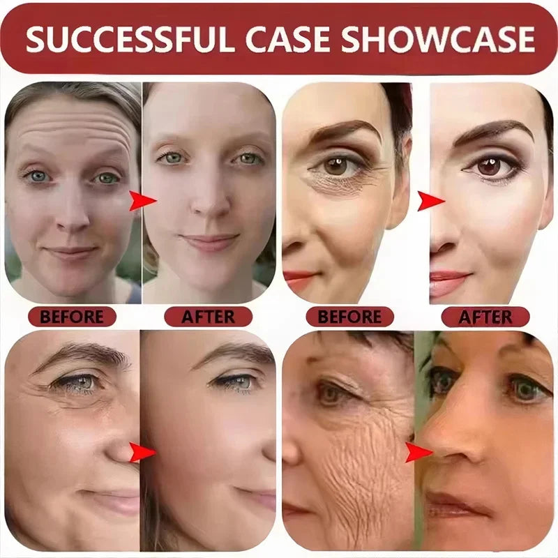 Korean 1988 Retinol Face Care Serum Black Ginseng Niacinamide 2% Acid Moisturizing Firming Cream Anti Aging Wrinkle Skin Care