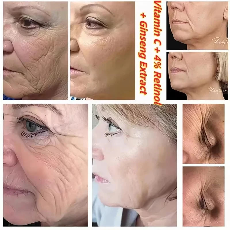 Korean 1988 Retinol Face Care Serum Black Ginseng Niacinamide 2% Acid Moisturizing Firming Cream Anti Aging Wrinkle Skin Care