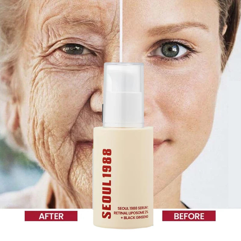 Korean 1988 Retinol Face Care Serum Black Ginseng Niacinamide 2% Acid Moisturizing Firming Cream Anti Aging Wrinkle Skin Care