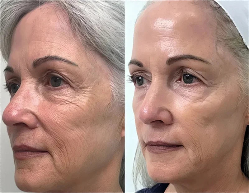 Korean 1988 Retinol Face Care Serum Black Ginseng Niacinamide 2% Acid Moisturizing Firming Cream Anti Aging Wrinkle Skin Care