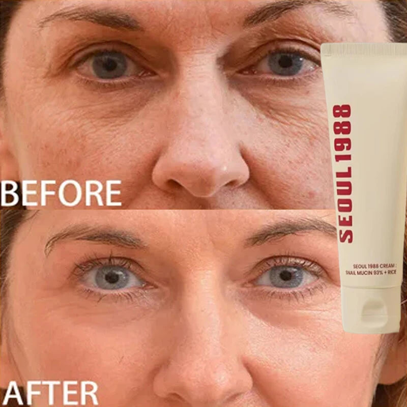 Korean 1988 Retinol Face Care Serum Black Ginseng Niacinamide 2% Acid Moisturizing Firming Cream Anti Aging Wrinkle Skin Care